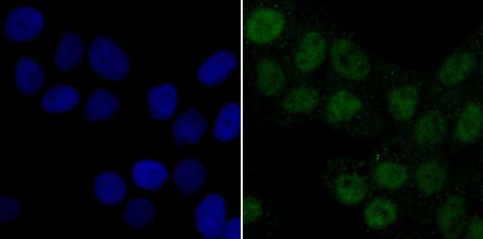 PDK1 Rabbit mAb