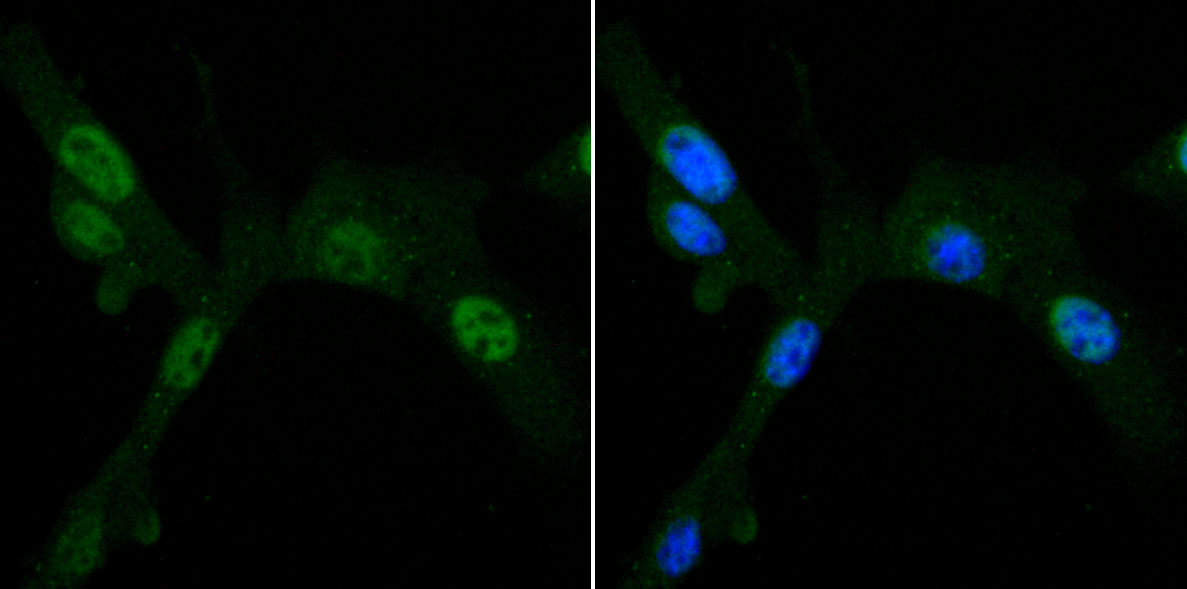 PDK1 Rabbit mAb