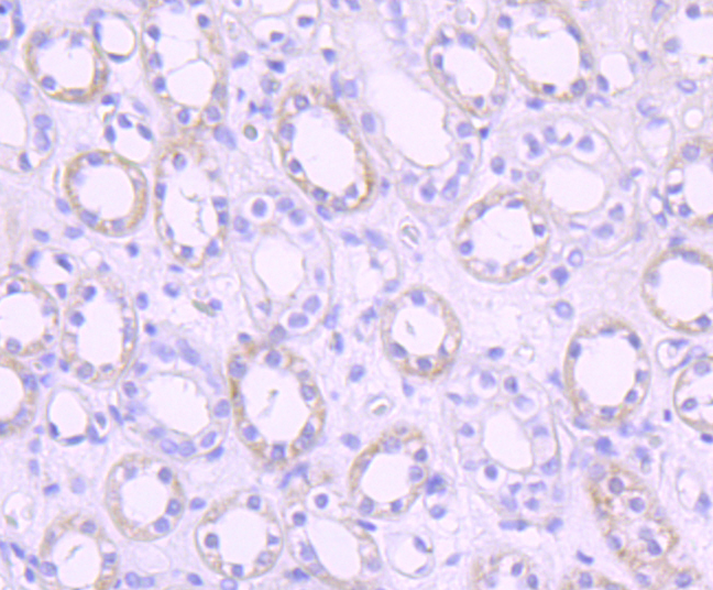 PDK1 Rabbit mAb