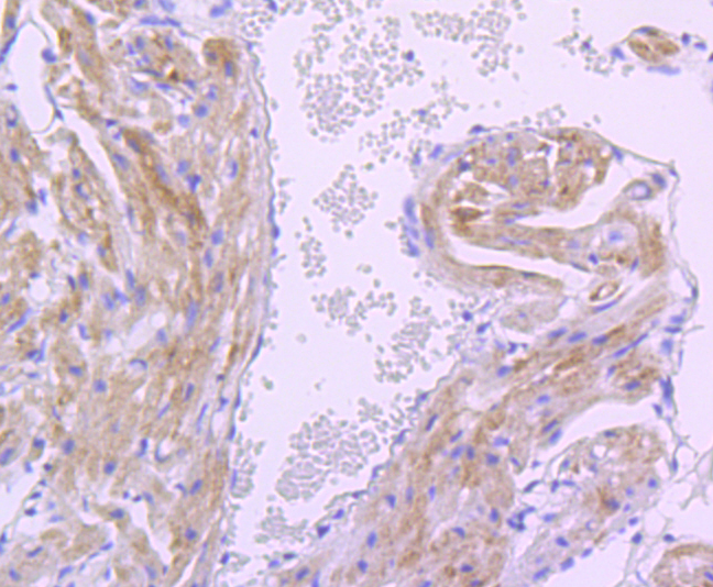 PDK1 Rabbit mAb