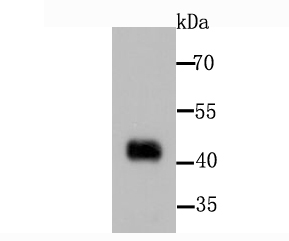 PDK1 Rabbit mAb