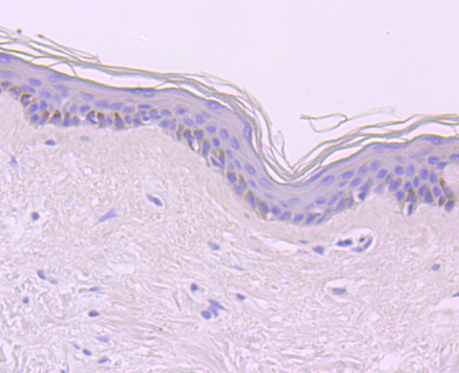 CDT1 Rabbit mAb