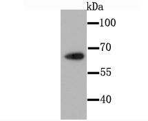 CDT1 Rabbit mAb