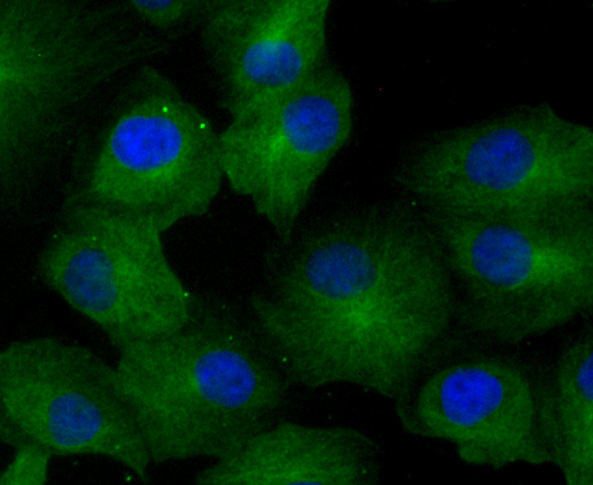 GCN2 Rabbit mAb