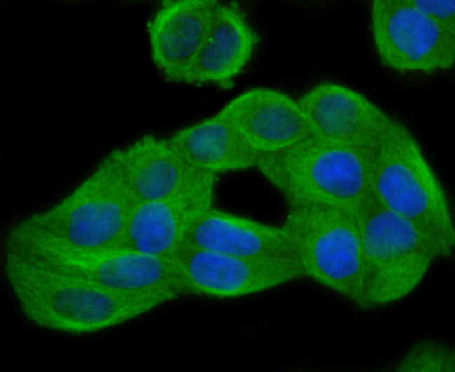 GCN2 Rabbit mAb