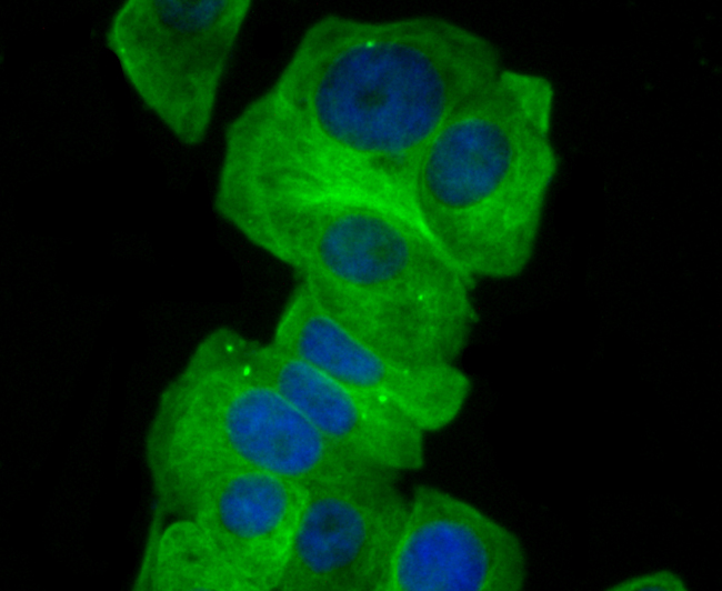 GCN2 Rabbit mAb