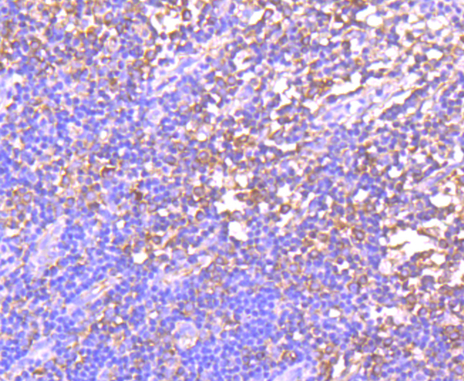 GCN2 Rabbit mAb