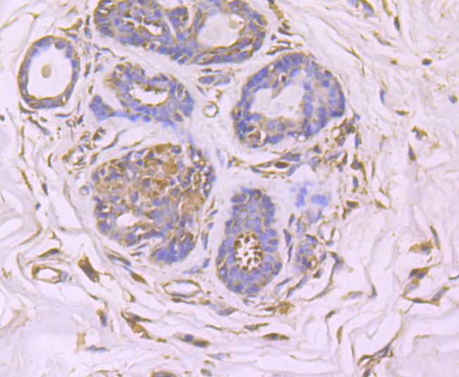 GCN2 Rabbit mAb