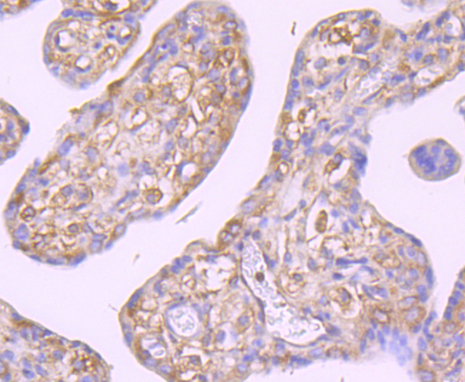 GCN2 Rabbit mAb