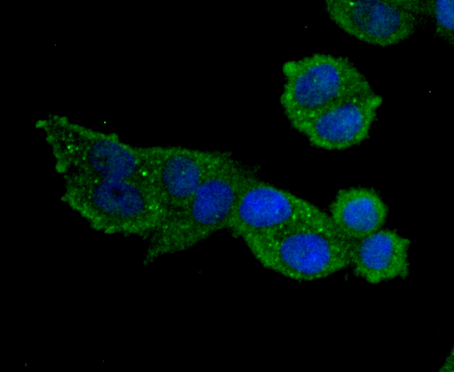 MMP9 Rabbit mAb