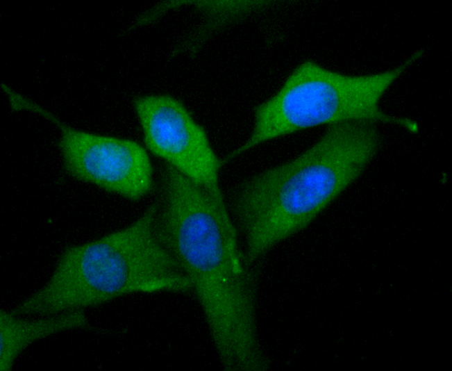 MMP9 Rabbit mAb