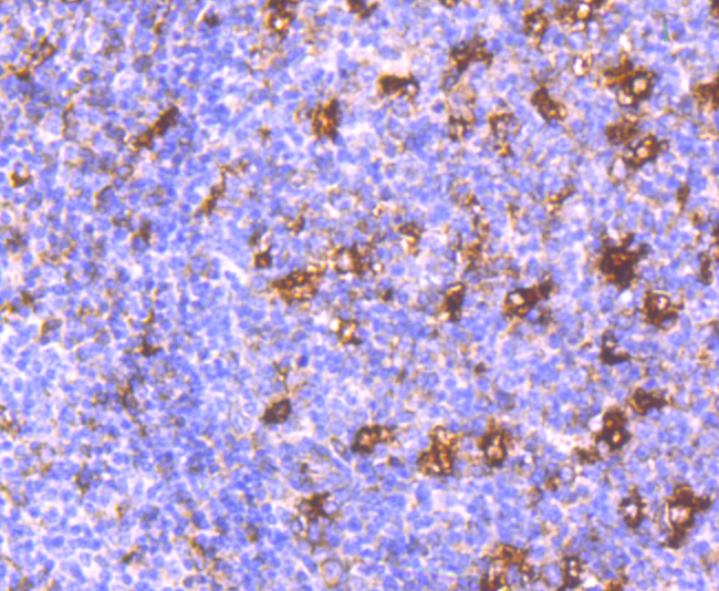 MMP9 Rabbit mAb