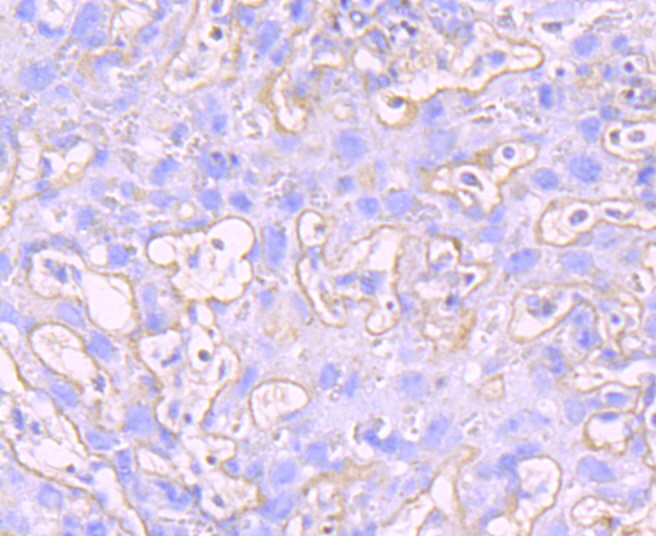 MMP9 Rabbit mAb