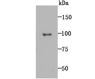 MMP9 Rabbit mAb