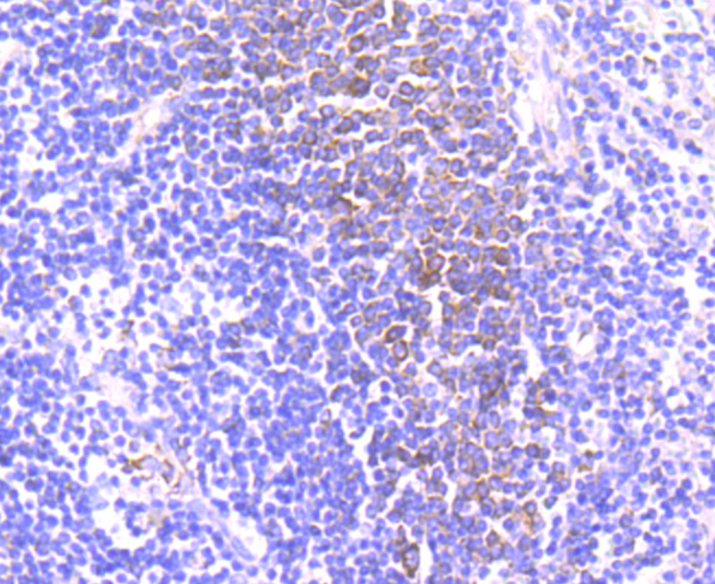 CD39 Rabbit mAb