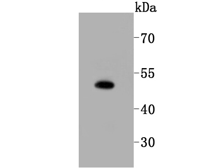 SPHK1 Rabbit mAb