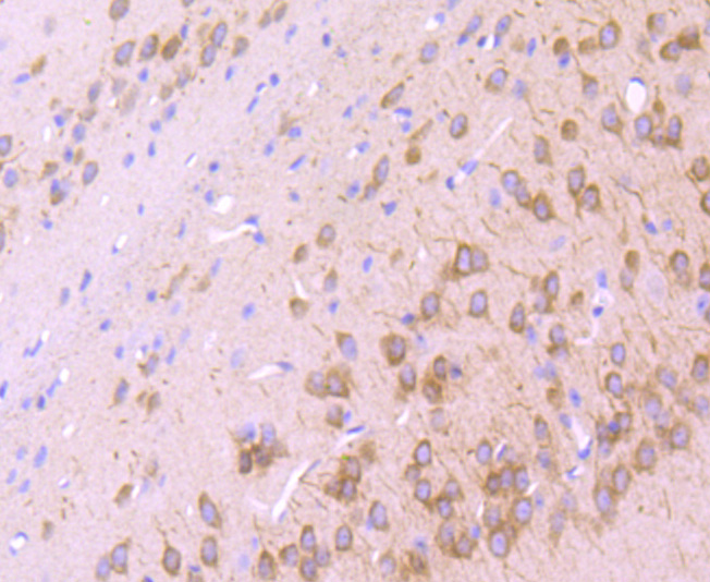 IP3 Receptor Rabbit mAb