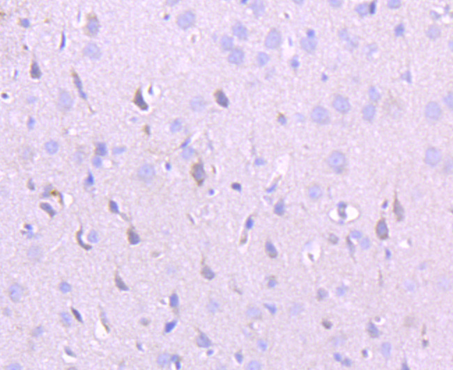 NMDAR2A Rabbit mAb