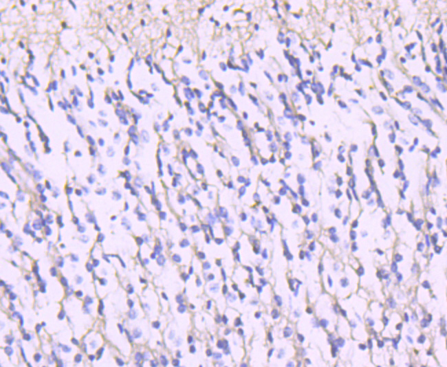 NMDAR2A Rabbit mAb