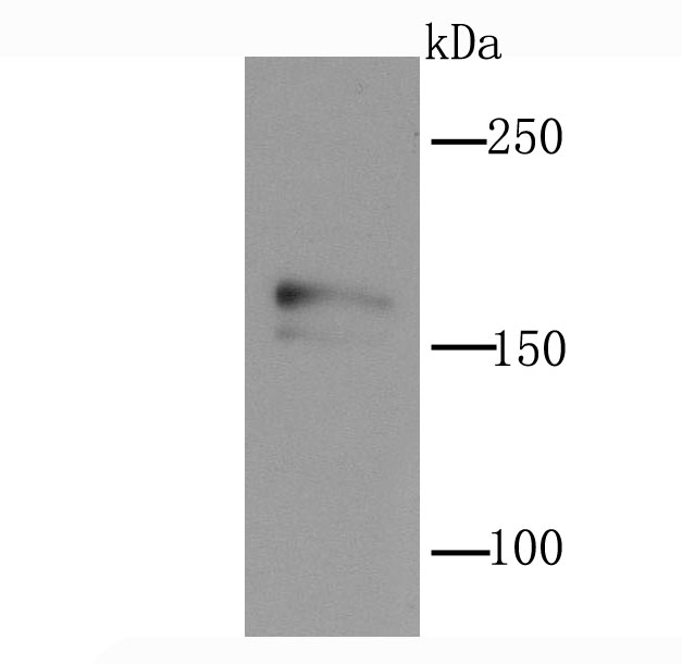 NMDAR2A Rabbit mAb