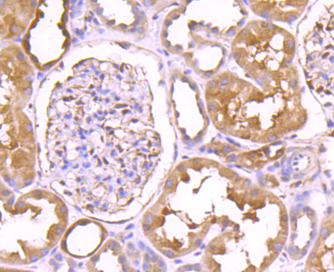 TXNRD1 Rabbit mAb