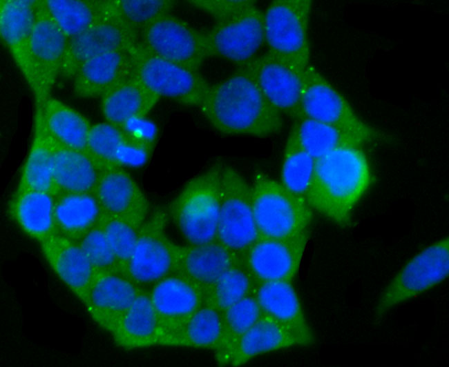 PKC epsilon Rabbit mAb