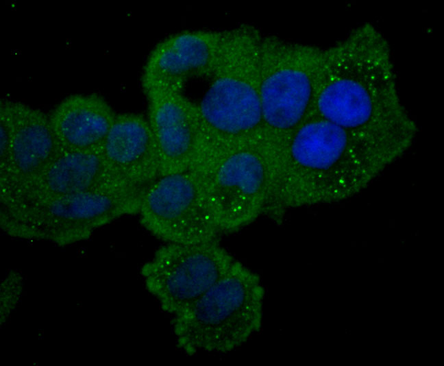 PKC epsilon Rabbit mAb