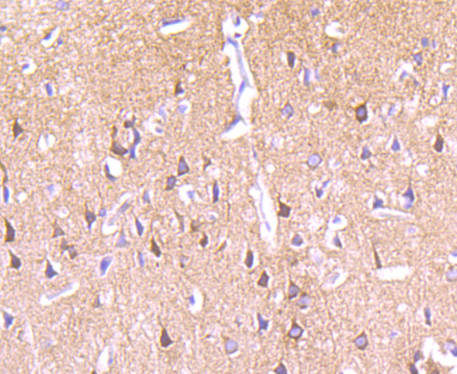 PKC epsilon Rabbit mAb