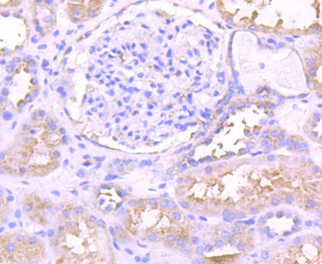 PKC epsilon Rabbit mAb