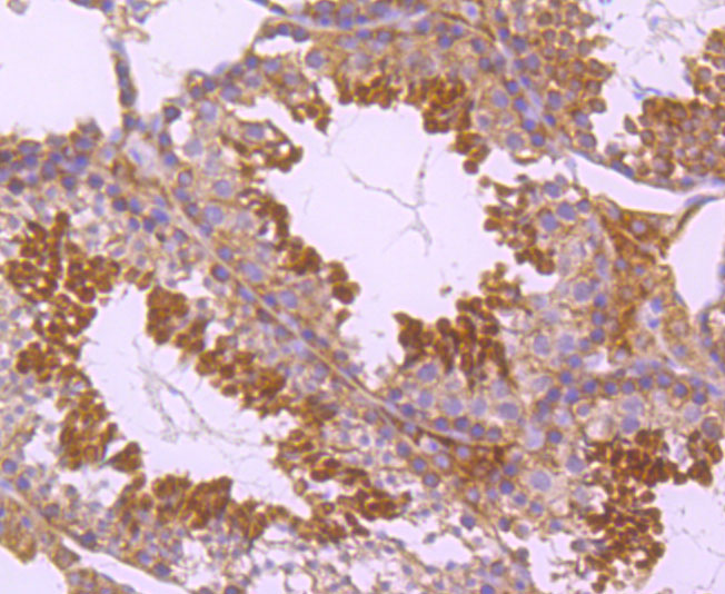 PKC epsilon Rabbit mAb