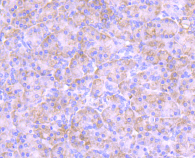 PKC epsilon Rabbit mAb