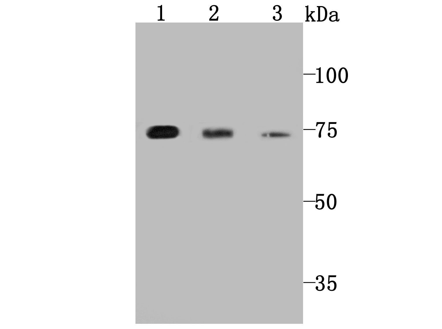 PKC epsilon Rabbit mAb