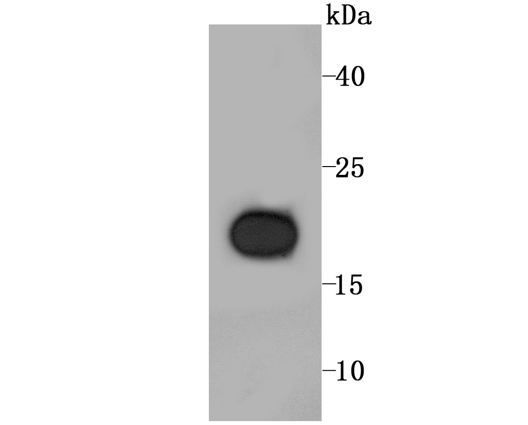 RBP4 Rabbit mAb