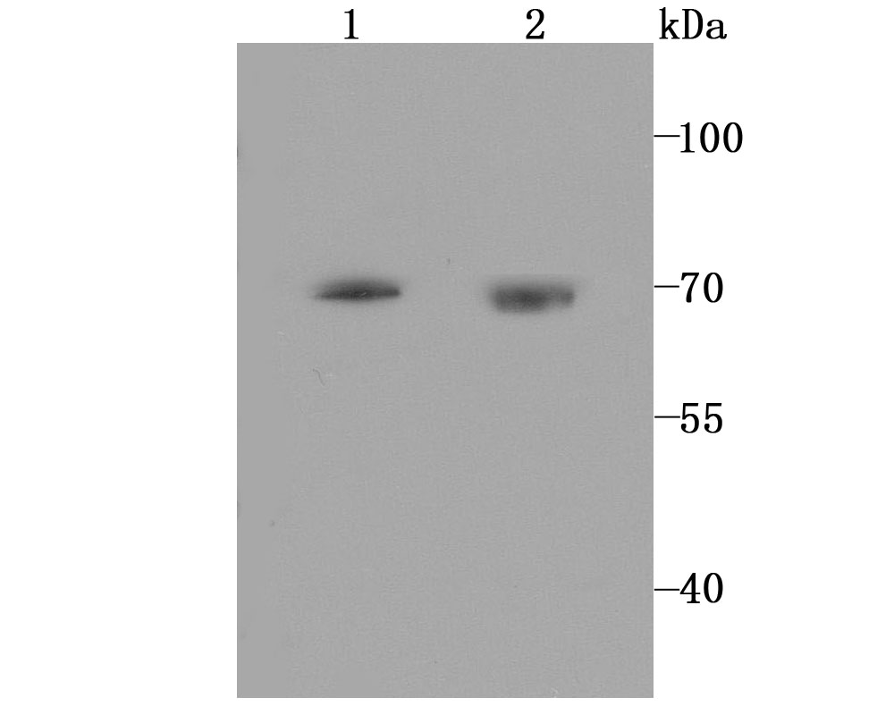 5HT2C Receptor Rabbit mAb