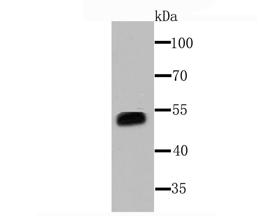 Cytochrome P450 3A4 Rabbit mAb