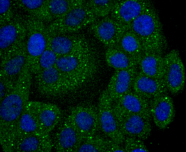 Calpain 2 Rabbit mAb