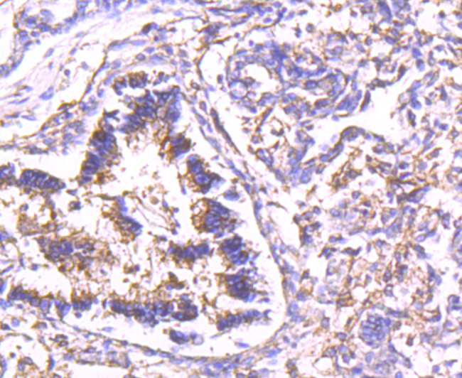 Calpain 2 Rabbit mAb