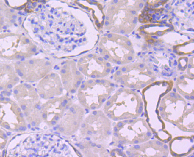 Calpain 2 Rabbit mAb