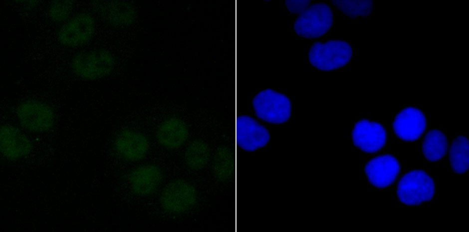 mSin3A Rabbit mAb