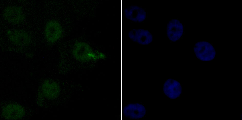 mSin3A Rabbit mAb