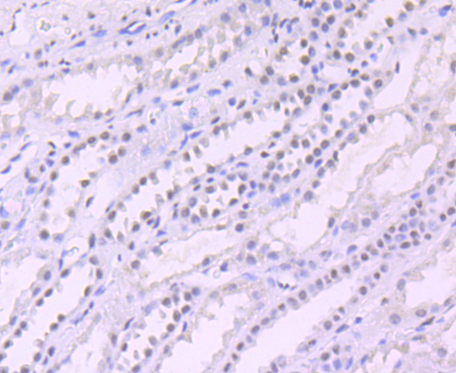 mSin3A Rabbit mAb