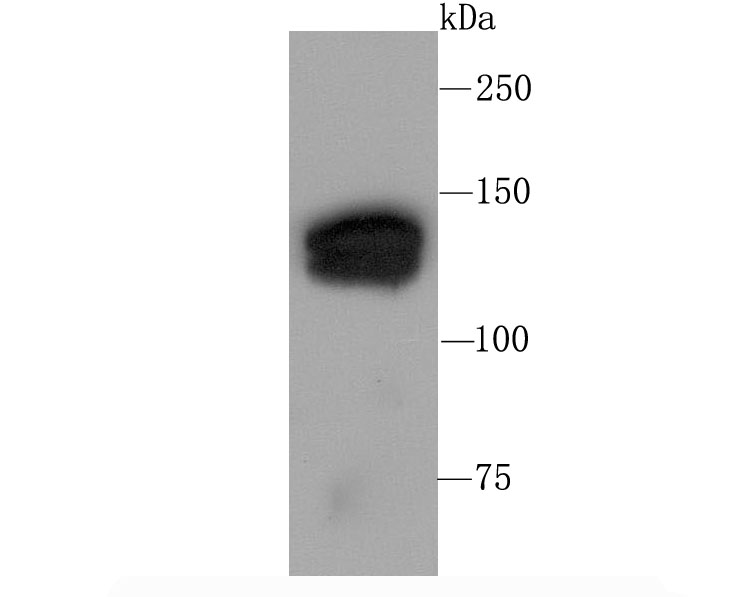 mSin3A Rabbit mAb