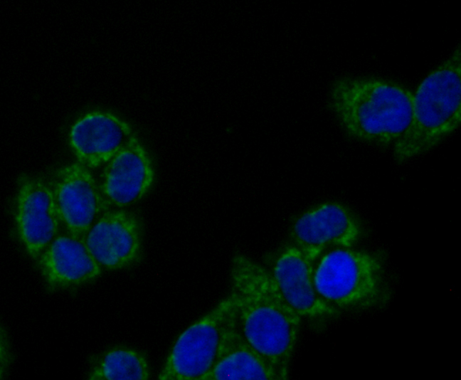 Peroxiredoxin 3 Rabbit mAb