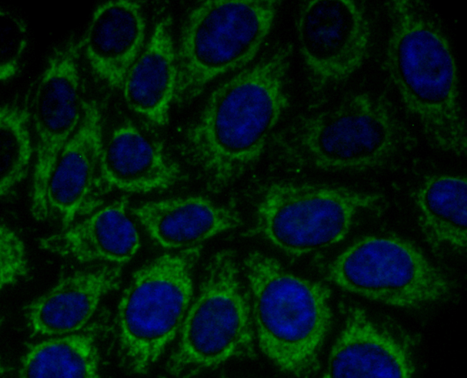 Peroxiredoxin 3 Rabbit mAb