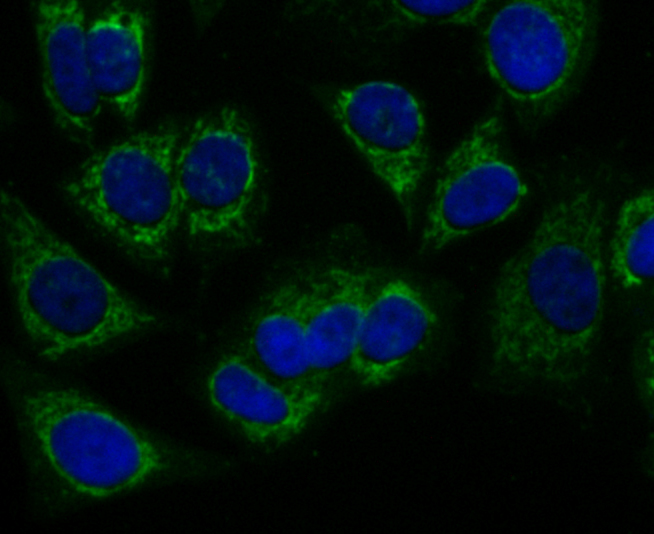 Peroxiredoxin 3 Rabbit mAb