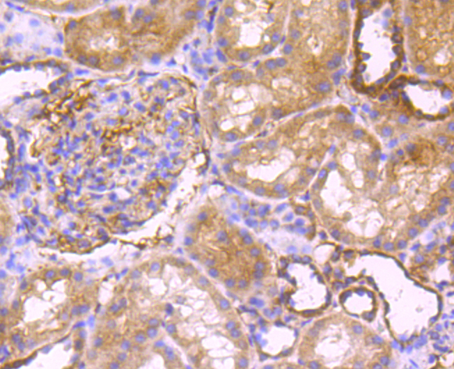 Peroxiredoxin 3 Rabbit mAb