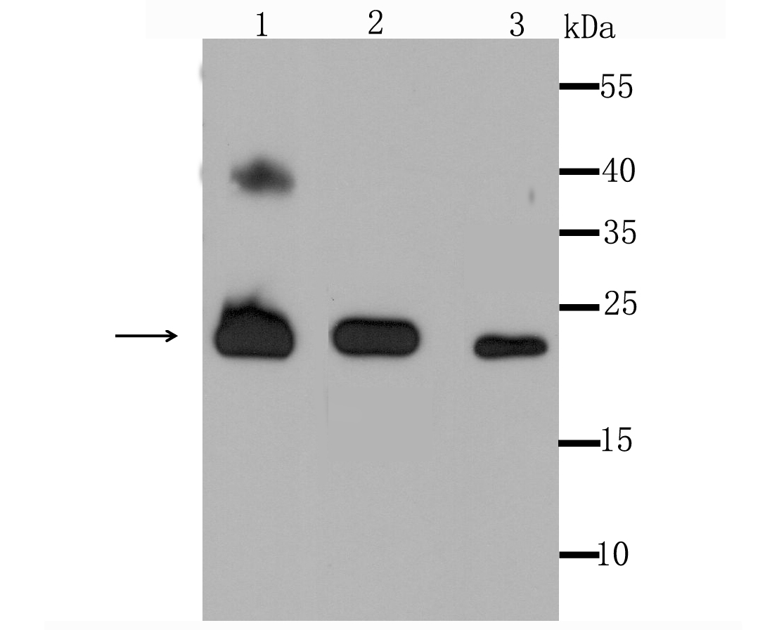 Peroxiredoxin 3 Rabbit mAb