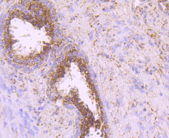 IDH2 Rabbit mAb