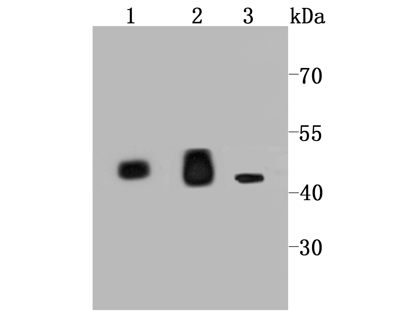 IDH2 Rabbit mAb