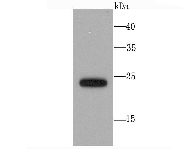 SNAP23 Rabbit mAb